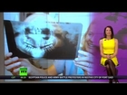 Fluoride Facts Exposed - Breaking News 3/8/13