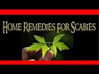 ★★★ Home Remedies For Scabies, How To Treat Scabies On Scalp, Scabies Rash Treatment, Treat Scabies