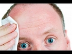 How To Stop Sweating So Much, Excessive Head Sweating, How To Reduce Armpit Sweat, Feet Sweat A Lot