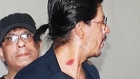 SPOTTED - Shahrukh Khan Shows His Love-Bite!