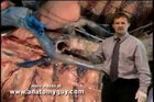 Posterior Mediastinium Human Anatomy Dissection Review.flv